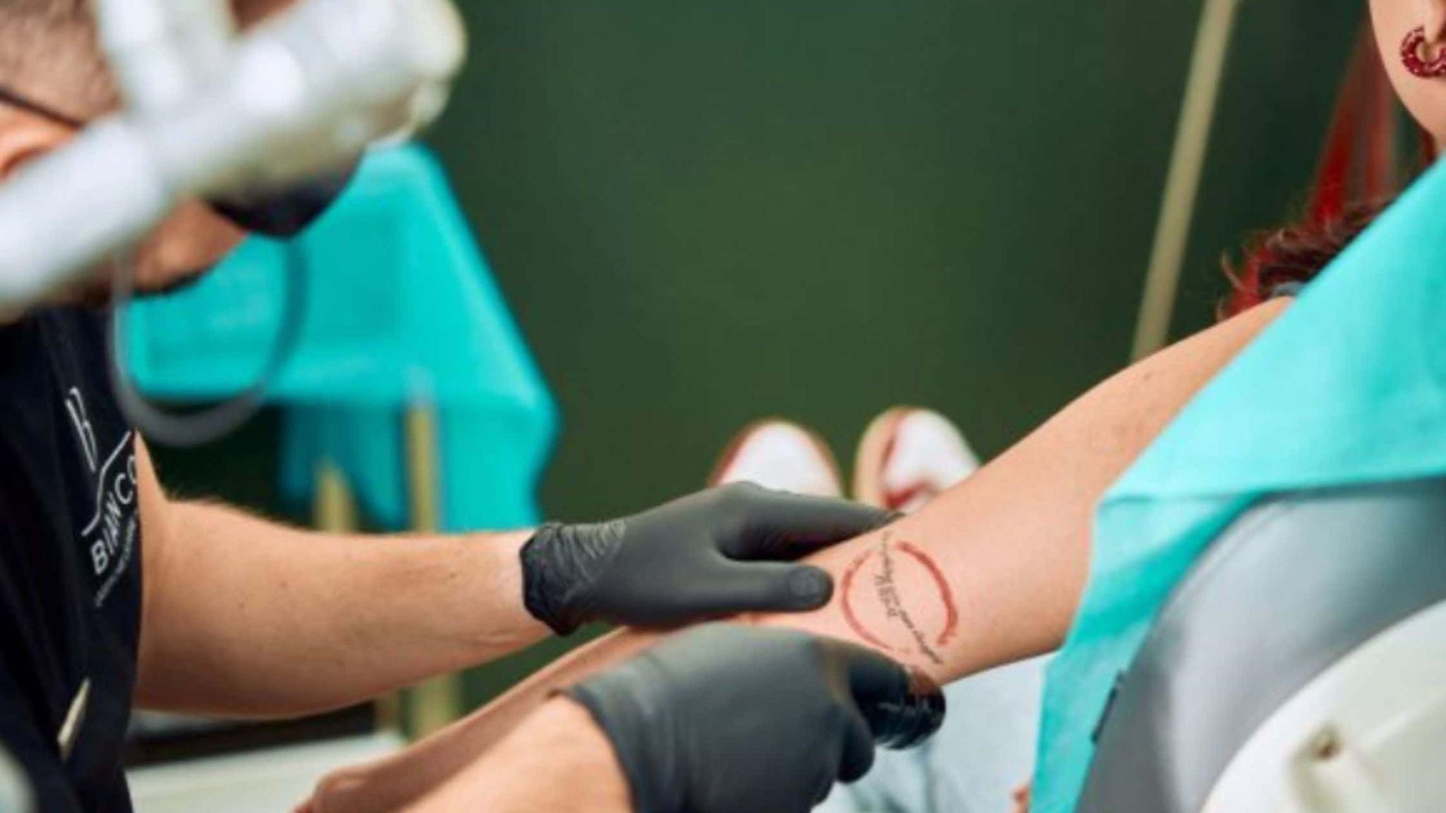 laserowe usuwanie tatuażu