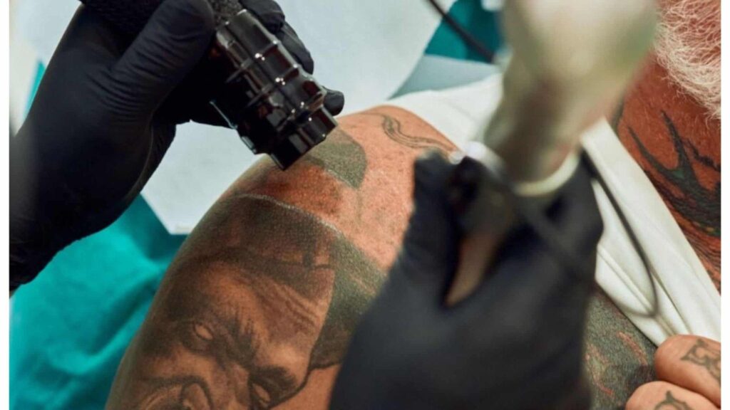 blizny po usuwaniu tatuażu